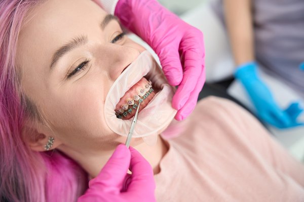 Optimisez votre sourire avec l'expertise d'un orthodontiste